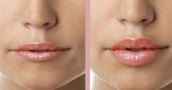 How to make lips bigger without surgery using makeup, bottles, exercises at home