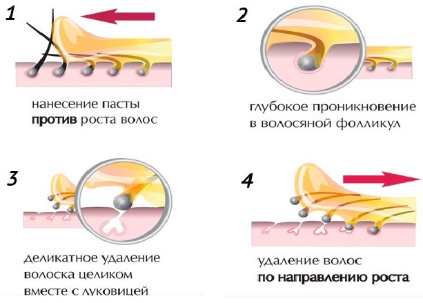 How to make shugaring to yourself at home. Recipe, video