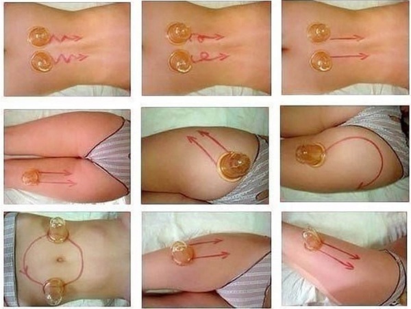 How to make a massage for slimming the abdomen and sides: vacuum, Chinese, visceral anti-cellulite, lymphatic drainage