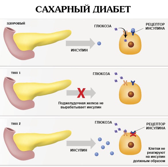 Breast reduction surgery mammoplasty. How much does a facelift cost, types, how to do it for free