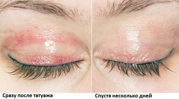 Permanent makeup of the space between the eyelashes. Photo, how long it lasts, price, how it is done