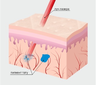 Permanent makeup of the space between the eyelashes. Photo, how long it lasts, price, how it is done