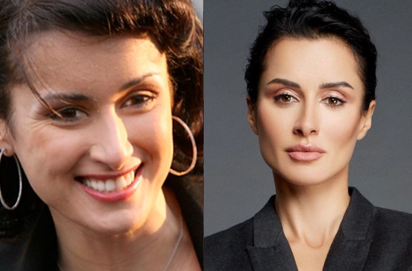 Tina Kandelaki. Photo of what it looks like in a swimsuit, before and after plastic surgery, without makeup, photoshop