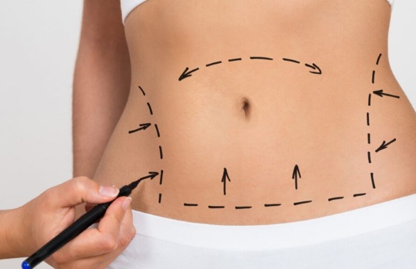 Non-surgical liposuction of the abdomen. Photo before and after laser, ultrasound, reviews, price