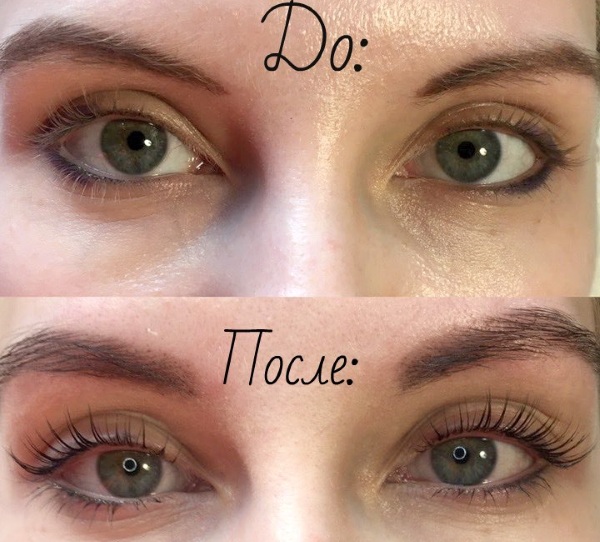 Botox or eyelash lamination: which is better, what is it, how is it different?