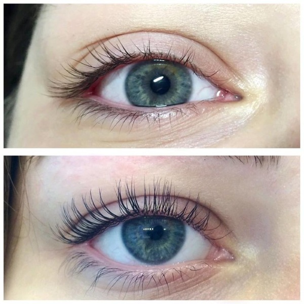 Botox or eyelash lamination: which is better, what is it, how is it different?