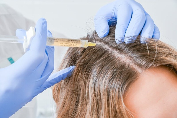 Dermahil for hair in mesotherapy. Composition, photos before and after, instructions for use