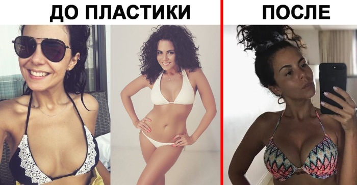 Nastya Kamenskikh. Photo in a swimsuit, without makeup, before and after plastic surgery, personal life