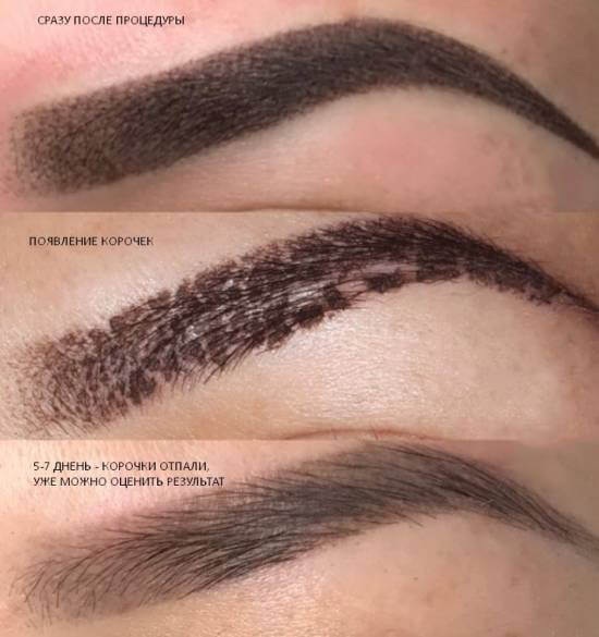 Permanent eyebrow makeup, powder dusting. Before and after photos, how long it lasts, healing