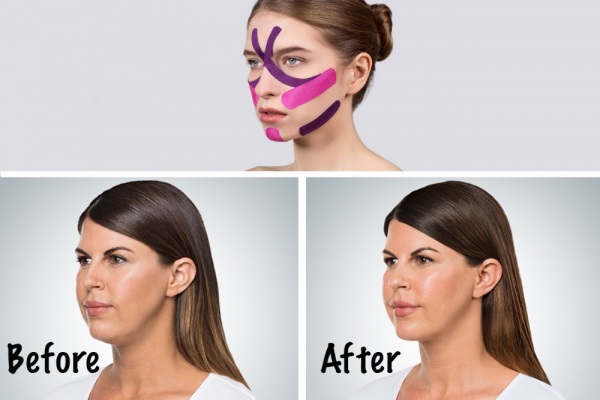 Face taping. Technique, instructions at home, video tutorials