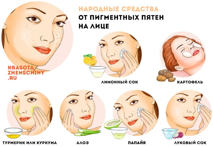 Remove pigmentation on the face at home quickly. Creams, folk remedies