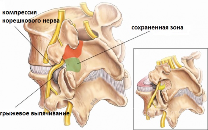 Exercises for straight posture in the gym and at home