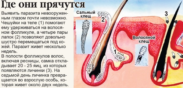 Azelaic acid. Preparations, instructions for use in cosmetology