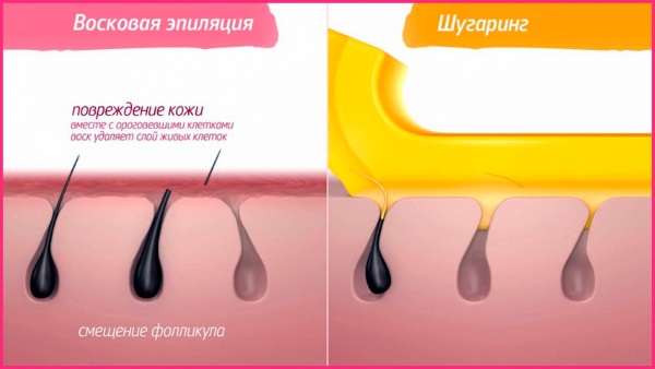 Depilation / hair removal at home with wax / sugar / honey, shugaring. How to do, recipes