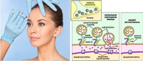 Refinex in cosmetology. Efficiency, side effects of use, reviews of cosmetologists