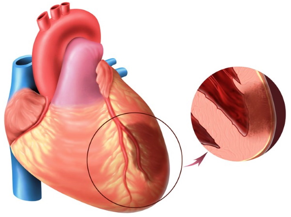 Rinoplastica del naso: chiusa, aperta, ricostruttiva, iniezione, laser. Prezzo e recensioni