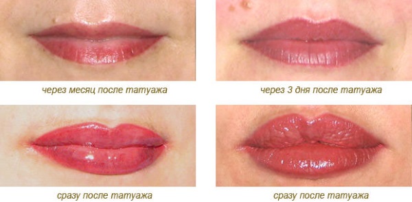 Lip tattoo. Before and after photos, consequences, reviews