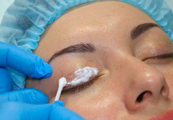 Anesthesia for permanent makeup of eyebrows, eyelids, lips, eyes. Which is better, reviews