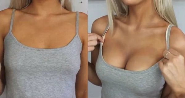 Breast augmentation surgery. Photos of girls with big breasts, results, possible complications