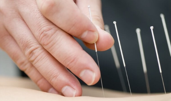 Acupuncture for weight loss. How it is done in the ear, on the body, the benefits and harms of acupuncture, reviews