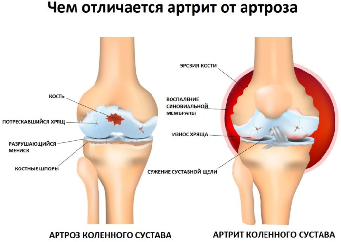 Estensione delle gambe nel simulatore stando seduti, sui quadricipiti, sdraiati. Benefici, tecnica, quali muscoli lavorano