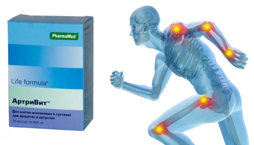 Vitamins for joints and ligaments for athletes. Best names, prices