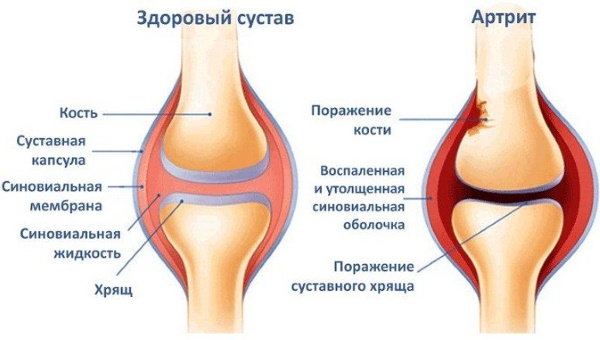 Extension and flexion of the legs in the simulator while sitting, lying, in the machine. Exercise, technique, which muscles work