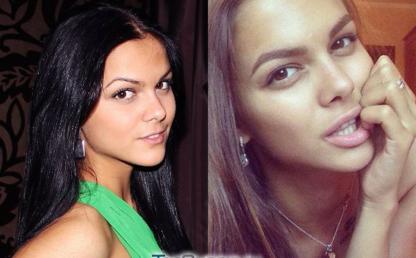 Victoria Odintsova. Photos before and after plastic surgery, in a swimsuit, height, weight, age, shape parameters, biography