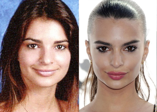 Emily Ratzkowski. Parameters, photos stolen, candid in a swimsuit, before and after plastic surgery