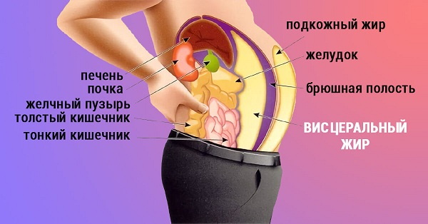 Hormoneller Bauch bei Frauen. So entfernen Sie, wie es aussieht, Gründe, Übungen