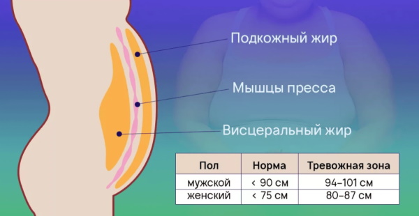 Hormoneller Bauch bei Frauen. So entfernen Sie, wie es aussieht, Gründe, Übungen