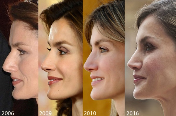 Queen Letizia of Spain. Photos before and after plastic surgery, height and weight, parameters