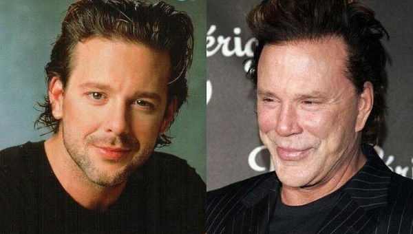 Mickey Rourke. Prima e dopo chirurgia plastica, chirurgia, foto in gioventù, ora, biografia, vita personale