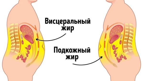 Subcutaneous abdominal fat. How to get rid of. How percentage is calculated, pills, diet, injections, exercises