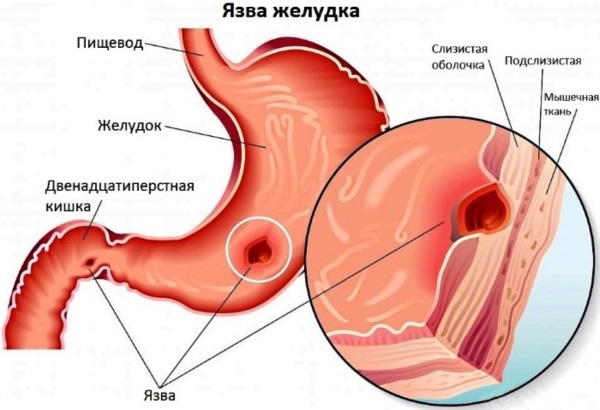 Porziola for weight loss. Reviews, instructions for use, analogues, price