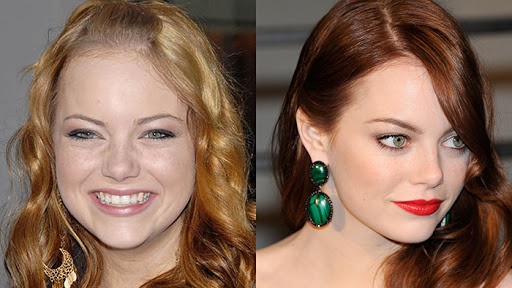 Emma Stone. Photos hot, in lingerie, swimsuit, before and after plastic surgery, biography, personal life