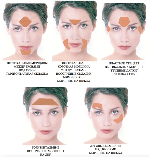 How to glue tapes on your face correctly. Taping for wrinkles, bags under the eyes. A photo