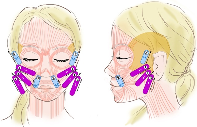 How to glue tapes on your face correctly. Taping for wrinkles, bags under the eyes. A photo