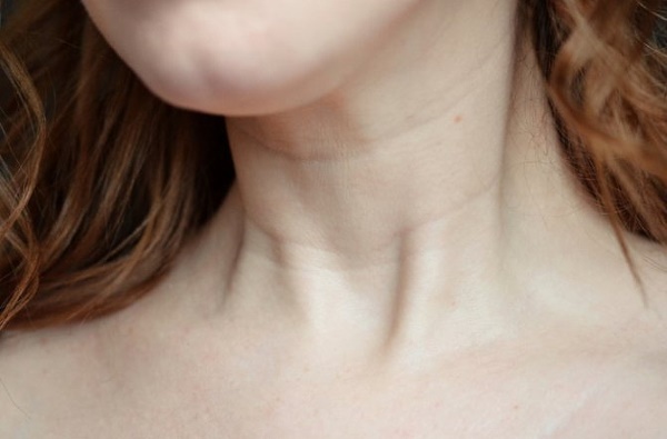 Venus rings on the neck. What do they mean, how to remove, reasons, photos