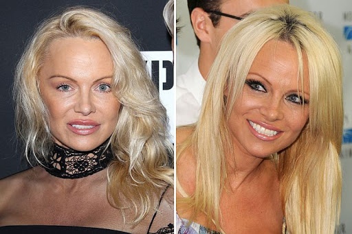 Pamela Anderson. Photos in his youth, now, Playboy, before and after plastic surgery, biography, personal life