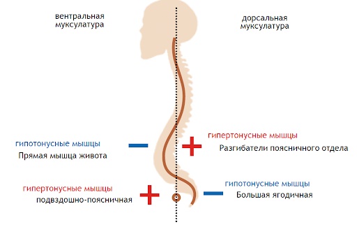 Iliopsoas muscle. Strengthening exercises, stretching, how to pump up