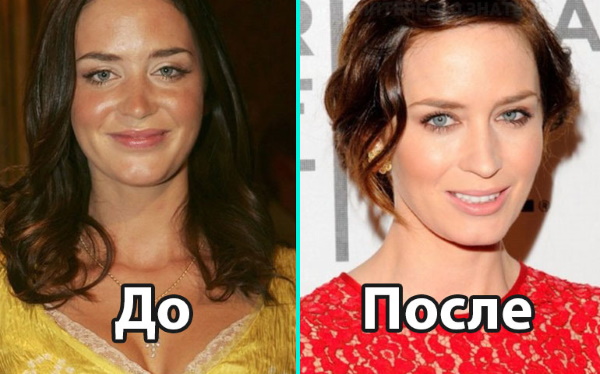 Emily Blunt. Photos hot in a swimsuit, before and after plastic surgery, biography, personal life