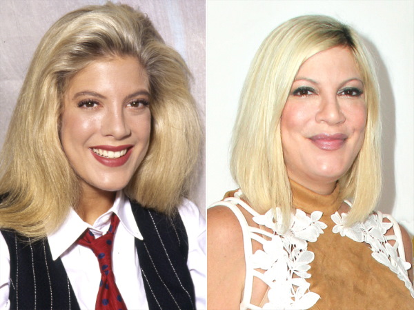 Tori Spelling. Foto in gioventù, adesso, prima e dopo la chirurgia plastica, senza trucco, in costume da bagno