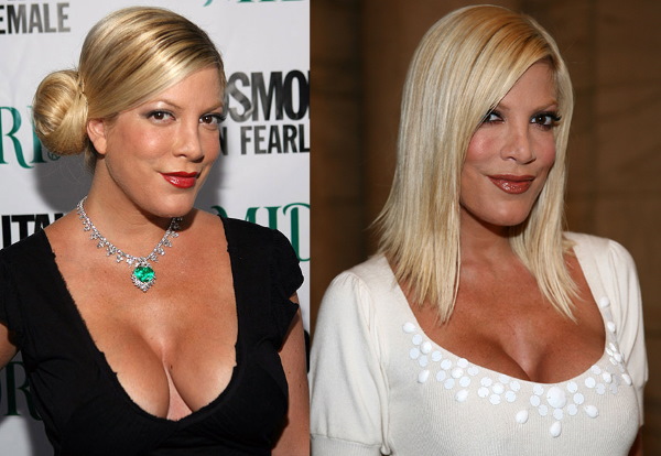 Tori Spelling. Photos in his youth, now, before and after plastic surgery, without makeup, in a swimsuit