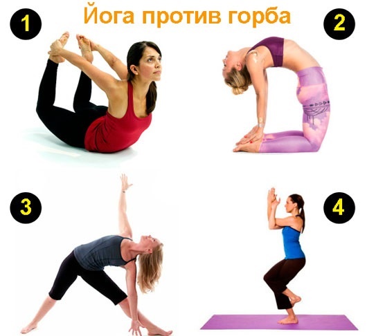 Exercises to remove a widow's hump. Video by Bubnovsky, Kurkurina, Shishonin