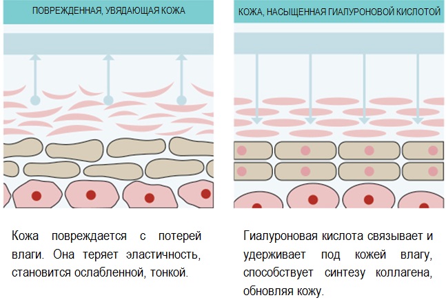 Botox analogs for the face of Russian production, France, Korea. Xeomin, Dysport, Relatox