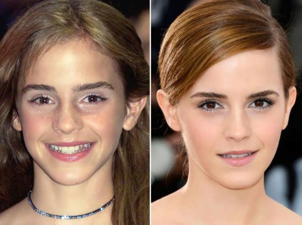 Emma Watson. Foto hot, candida in costume da bagno, figura, biografia, vita personale