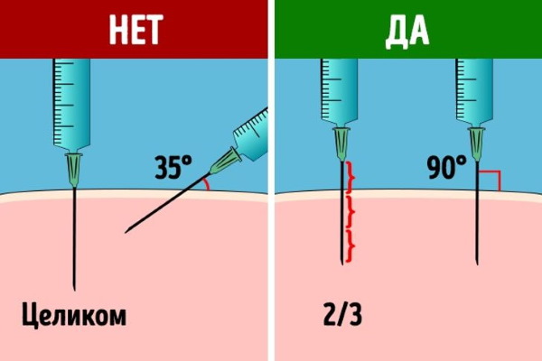 Nicotine (nicotinic acid) in injections. Instructions, indications for use, course of treatment