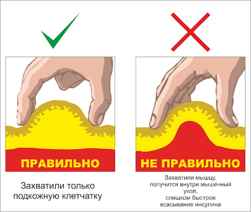 Nicotine (nicotinic acid) in injections.Instructions, indications for use, course of treatment