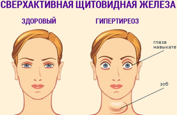 Nicotine (nicotinic acid) in injections. Instructions, indications for use, course of treatment